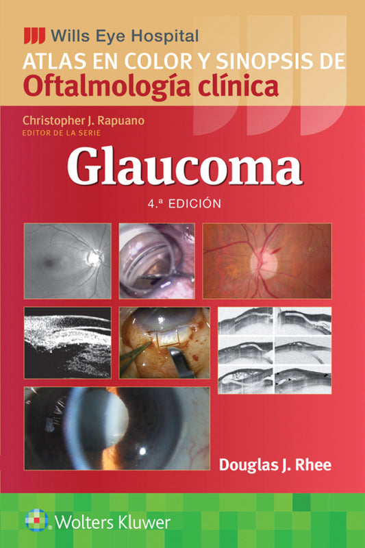 Glaucoma. Atlas en Color y Sinopsis de Oftalmología Clínica. WILLS EYE HOSPITAL