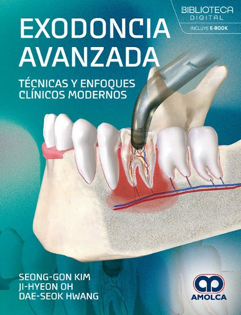 Exodoncia Avanzada. Técnicas y Enfoques Clínicos Modernos