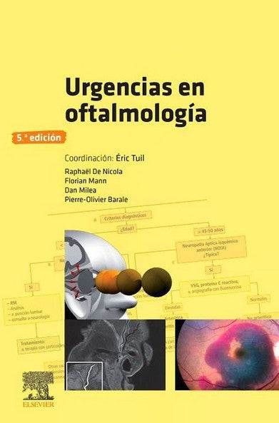 Urgencias en Oftalmología