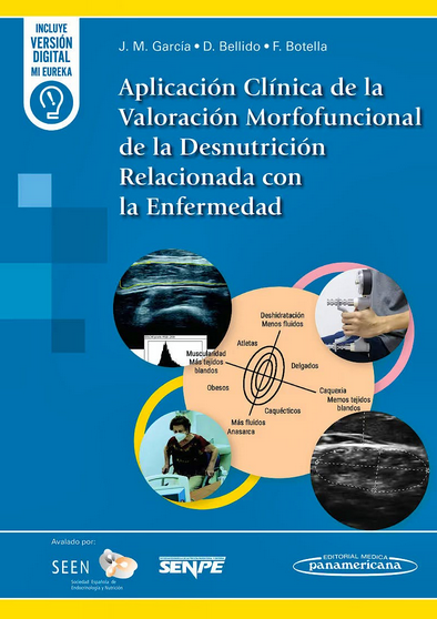 Aplicación Clínica de la Valoración Morfofuncional de la Desnutrición Relacionada con la Enfermedad