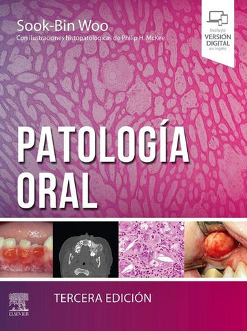 Patología Oral