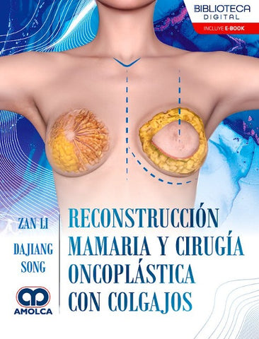 Reconstrucción Mamaria y Cirugía Oncoplástica con Colgajos