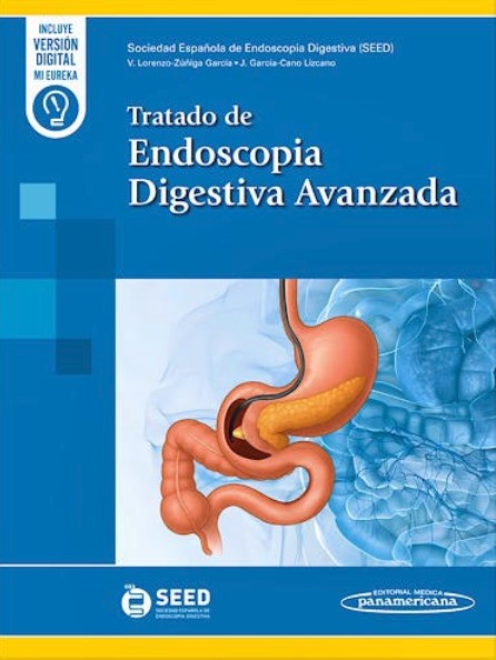 Tratado de Endoscopia Digestiva Avanzada