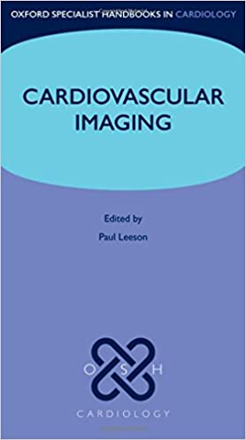 Cardiovascular imaging