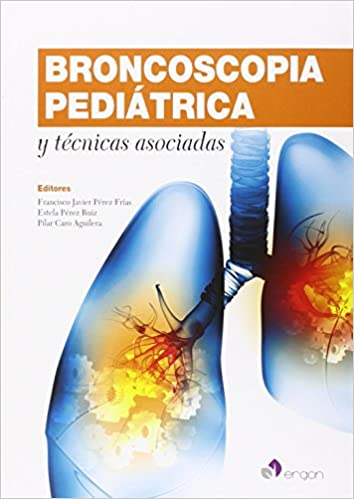 Broncoscopia Pediátrica y técnicas asociadas