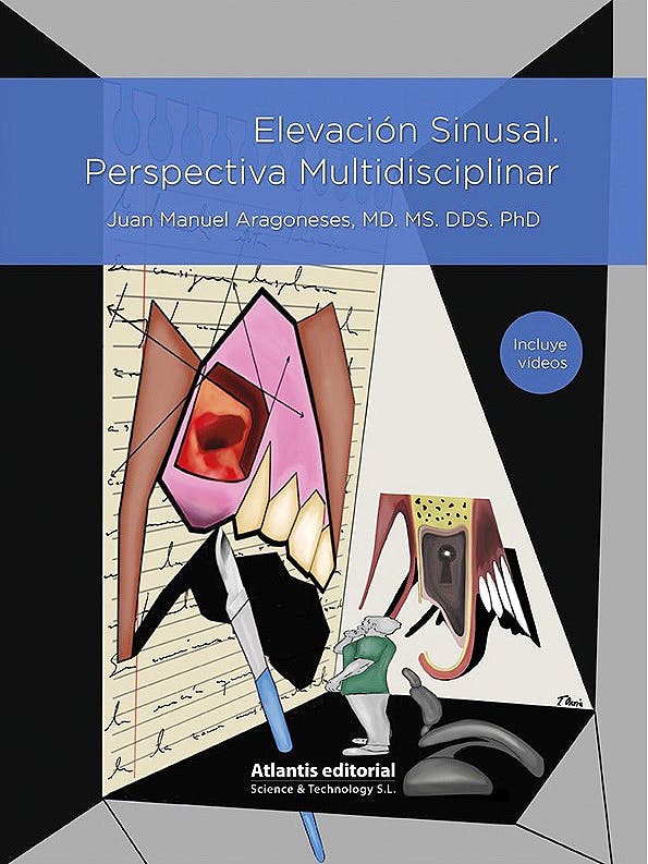 Elevación Sinusal. Perspectiva Multidisciplinar