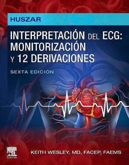 HUSZAR Interpretación del ECG: Monitorización y 12 Derivaciones