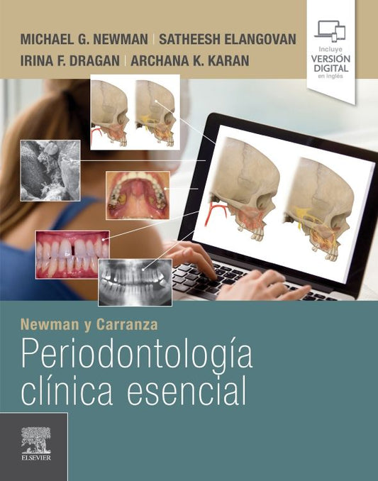 NEWMAN y CARRANZA. Periodontología Clínica Esencial