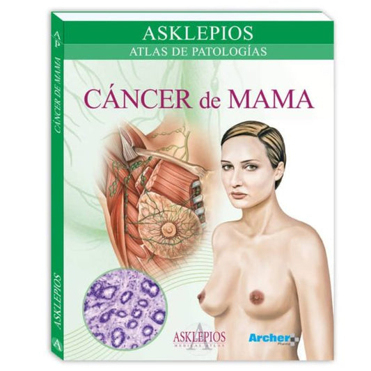 Cáncer de Mama. Atlas de Patología - Asklepios