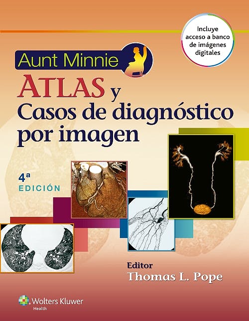 Aunt Minnie Atlas y Casos de Diagnóstico por Imagen