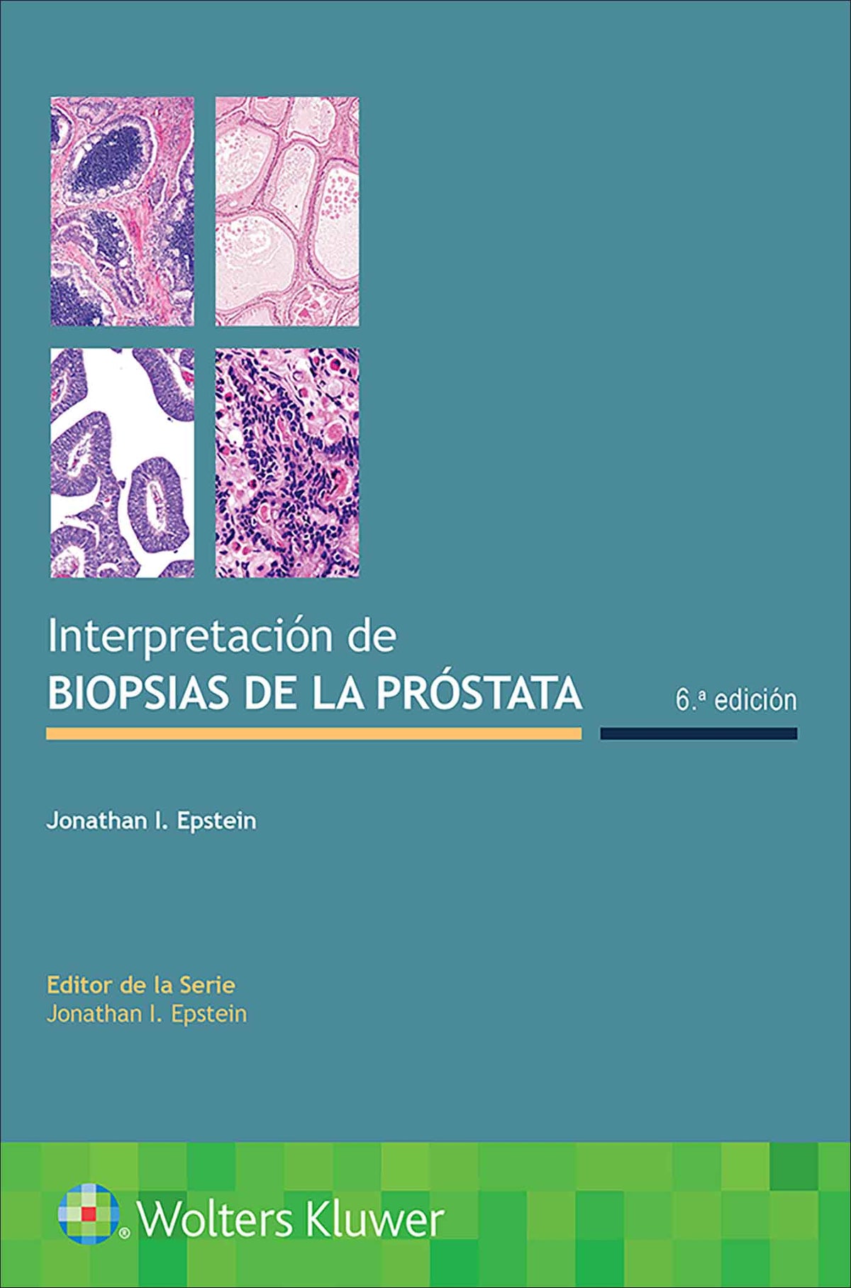 Interpretación de Biopsias de la Próstata