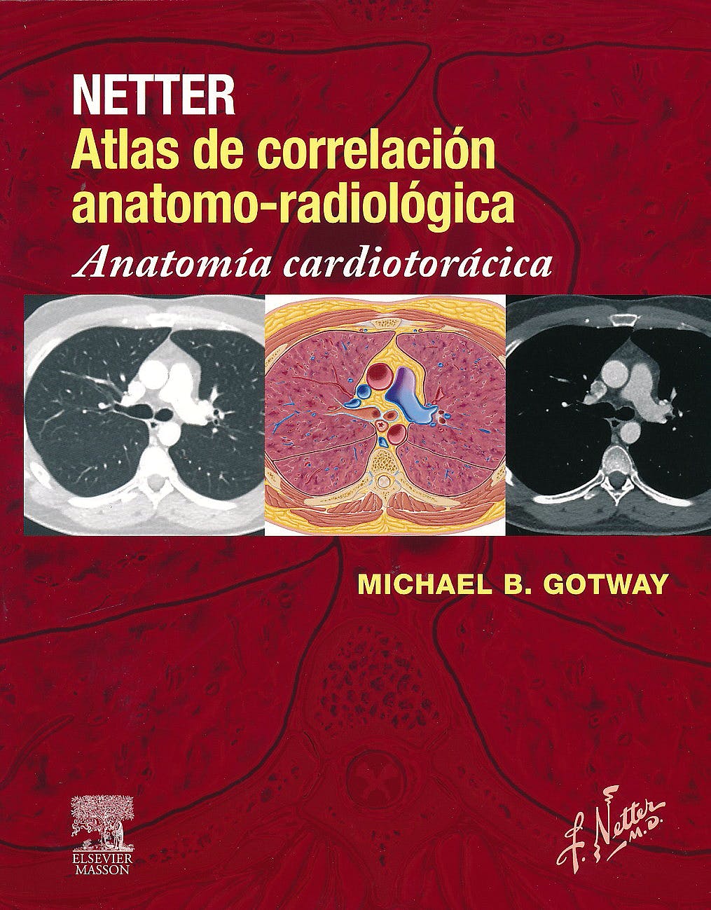 Netter Atlas de correlación anatomo-radiológica: Anatomía cardiotorácica