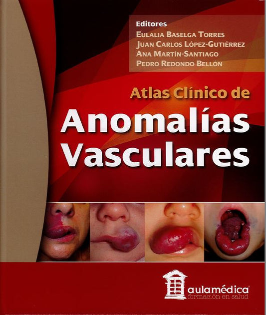 Atlas Clínico de Anomalías Vasculares