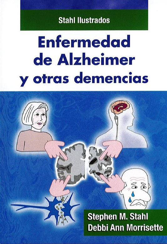 Enfermedad de Alzheimer y Otras Demencias