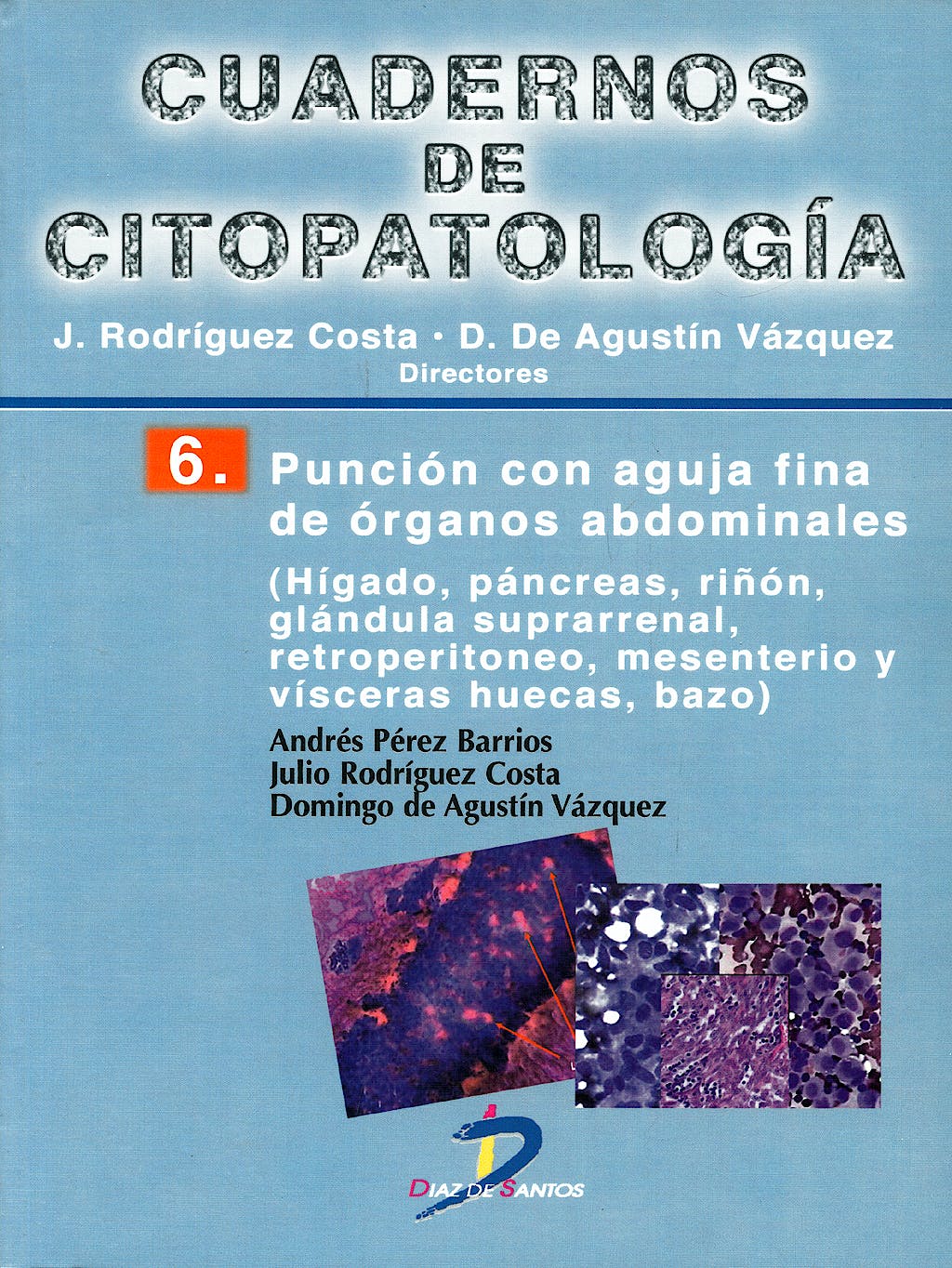 Cuadernos de Citopatología 6: Punción con Aguja Fina de Órganos Abdominales
