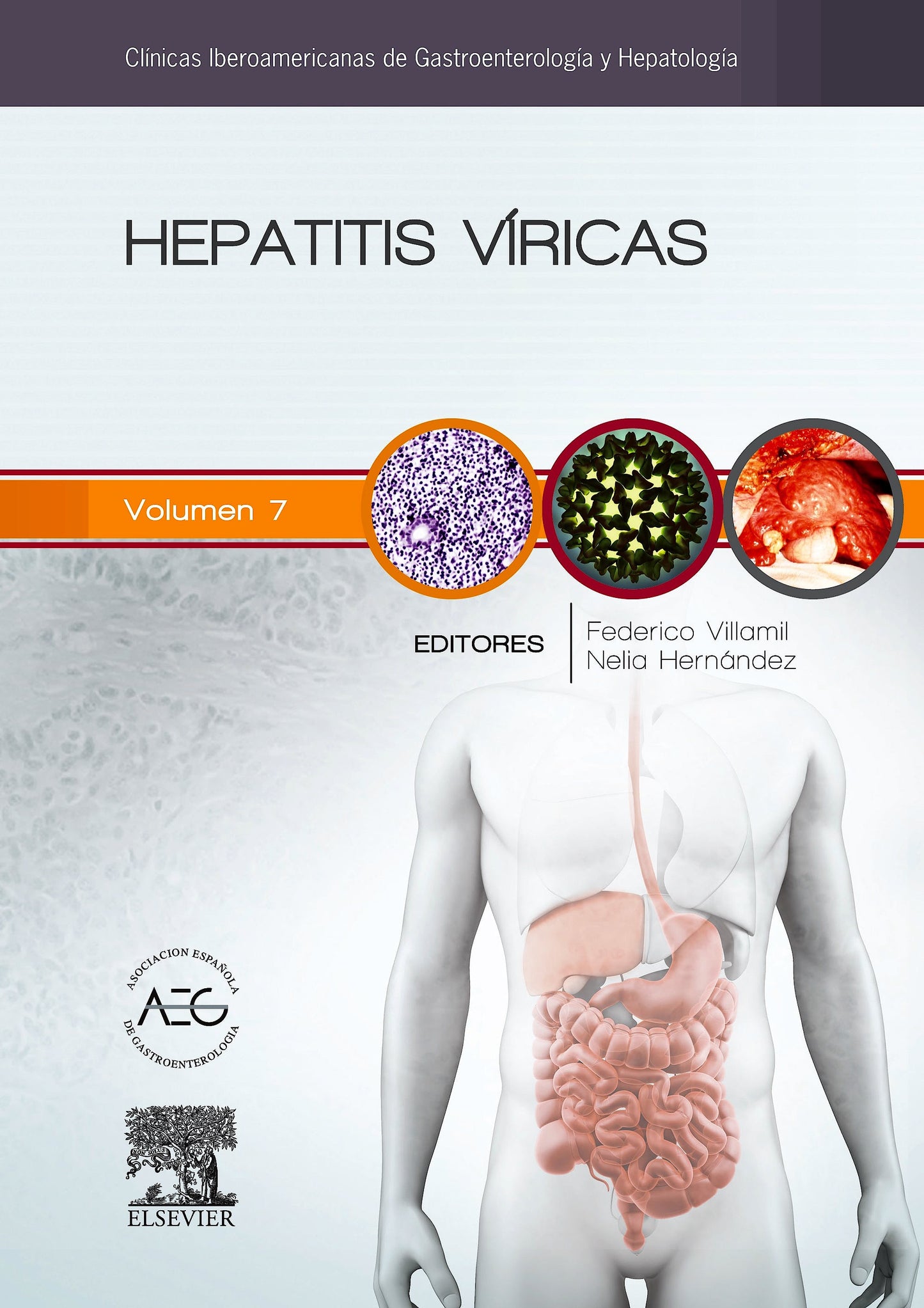 Hepatitis Víricas