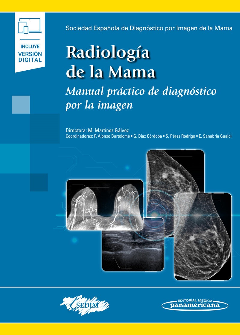 Radiología de la Mama. Manual Práctico de Diagnóstico por la Imagen