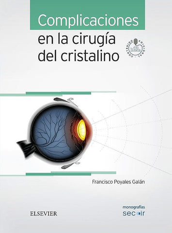 Complicaciones en la Cirugía del Cristalino. SECOIR