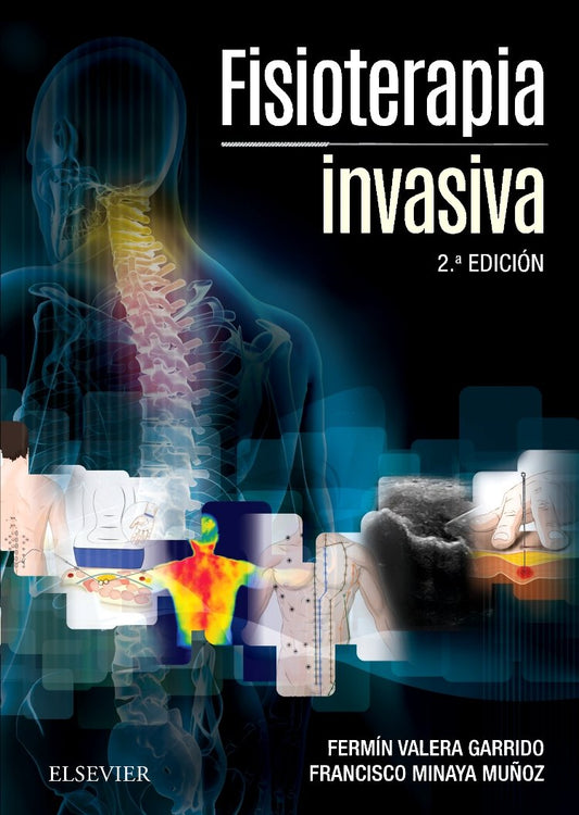 Fisioterapia Invasiva