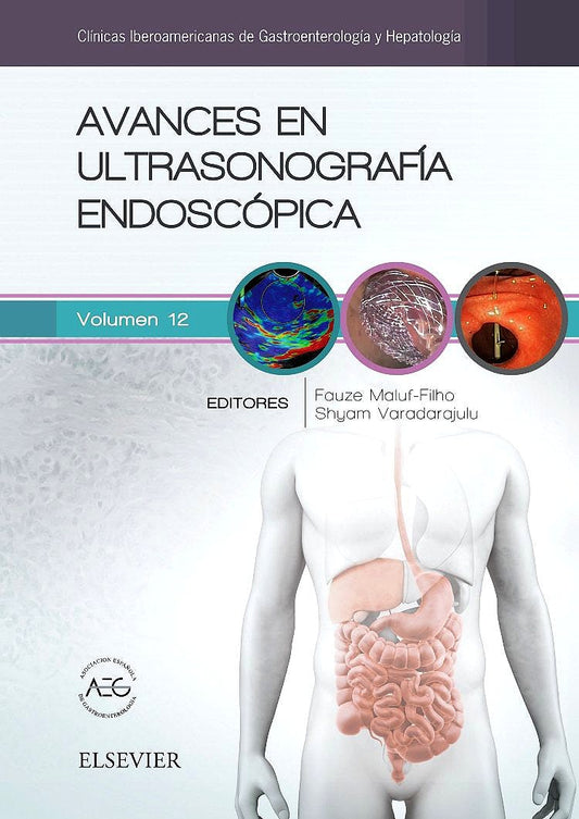 Avances en Ultrasonografía Endoscópica