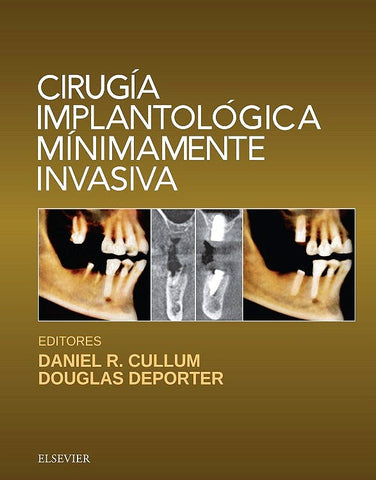 Cirugía Implantológica Mínimamente Invasiva