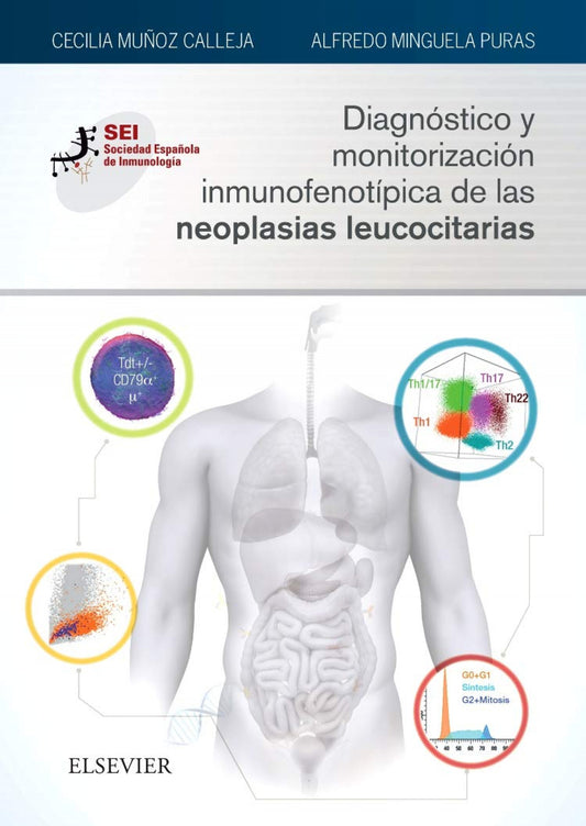 Diagnóstico y Monitorización Inmunofenotípica de las Neoplasias Leucocitarias