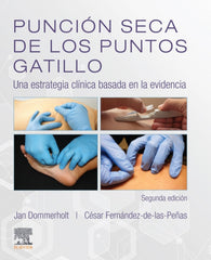 Punción Seca de los Puntos Gatillo. Una Estrategia Clínica Basada en la Evidencia