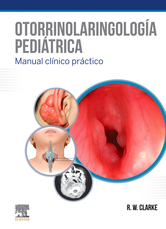 Otorrinolaringología Pediátrica. Manual Clínico Práctico