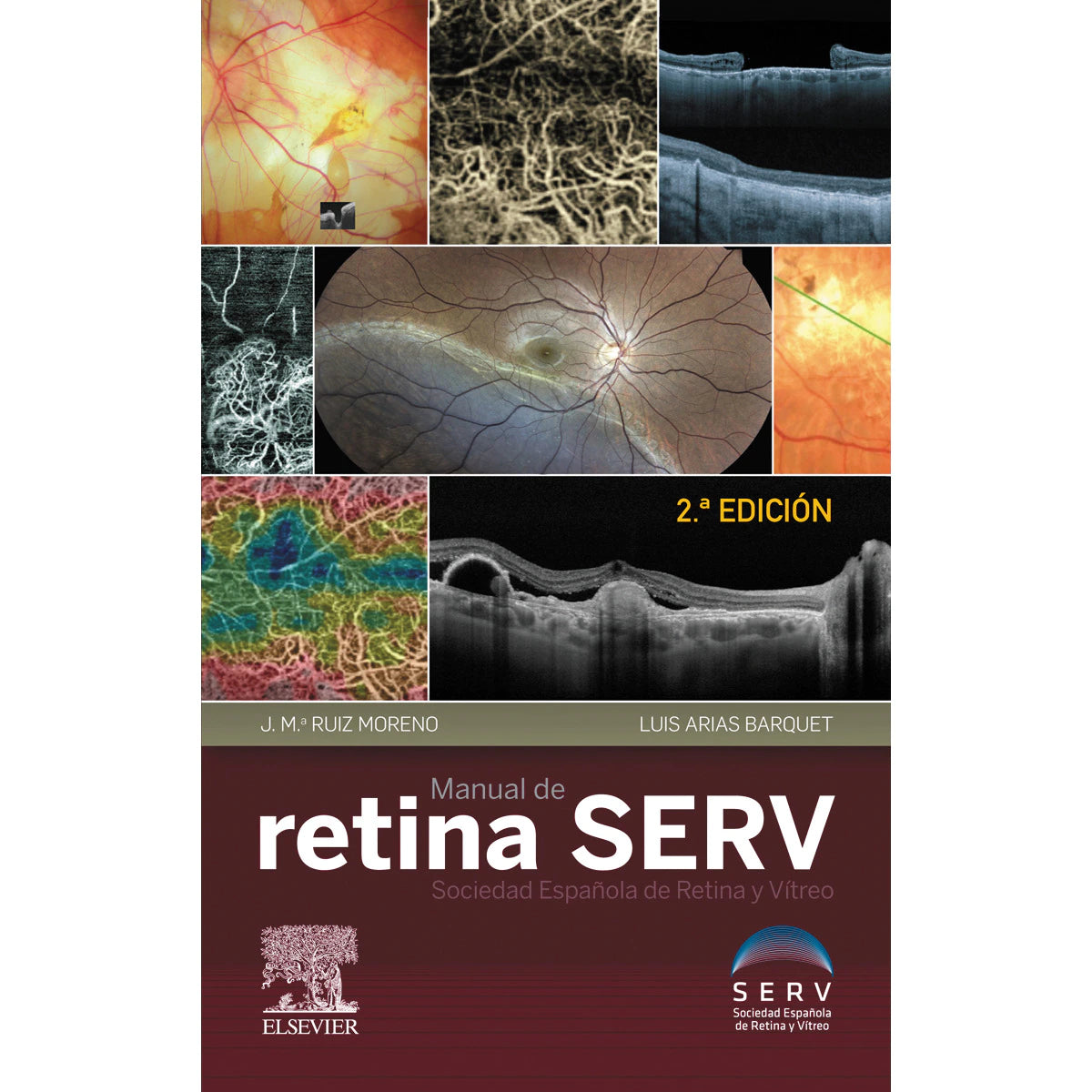 Manual de Retina SERV