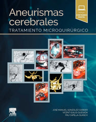 Aneurismas Cerebrales. Tratamiento Microquirúrgico