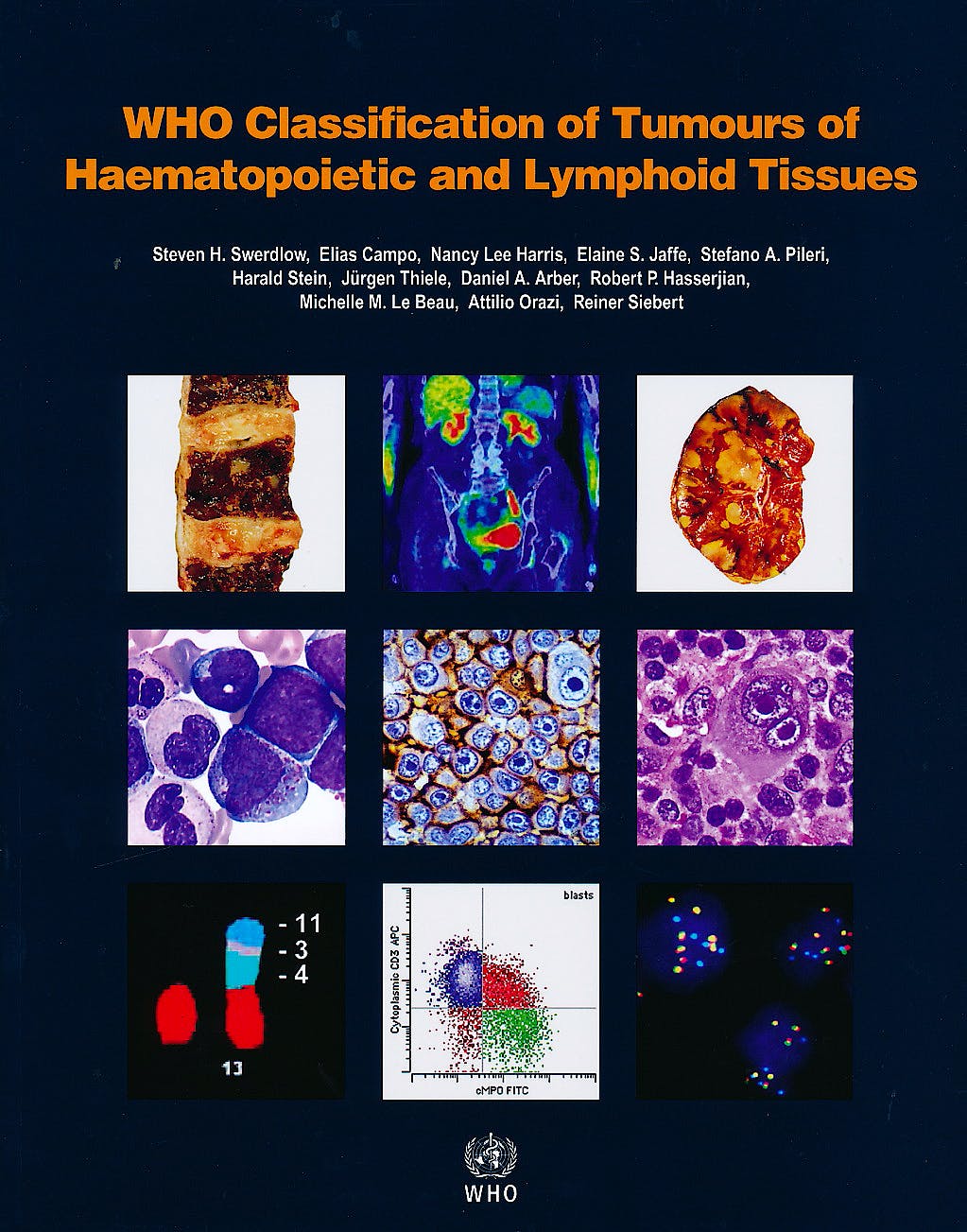 WHO Classification of Tumours of Haematopoietic and Lymphoid Tissues  Vol. 2