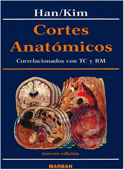 Cortes Anatómicos correlacionados con TC y RM