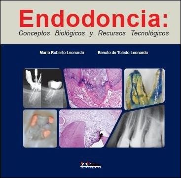 Endodoncia: Conceptos Biológicos y Recursos Tecnológicos