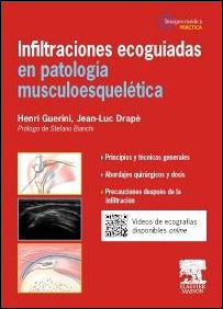 Infiltraciones Ecoguiadas en Patología Musculoesquelética