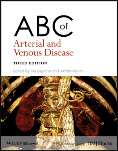 ABC of Arterial and Venous Disease