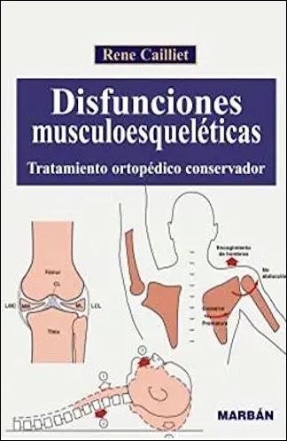 Disfunciones Musculoesqueléticas - Tratamiento ortopédico conservador