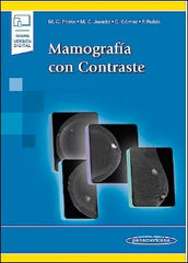 Mamografía con Contraste