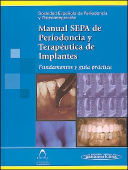 Manual SEPA de Periodoncia Terapéutica de Implantes