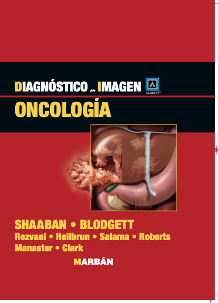 Diagnóstico por Imagen Oncología