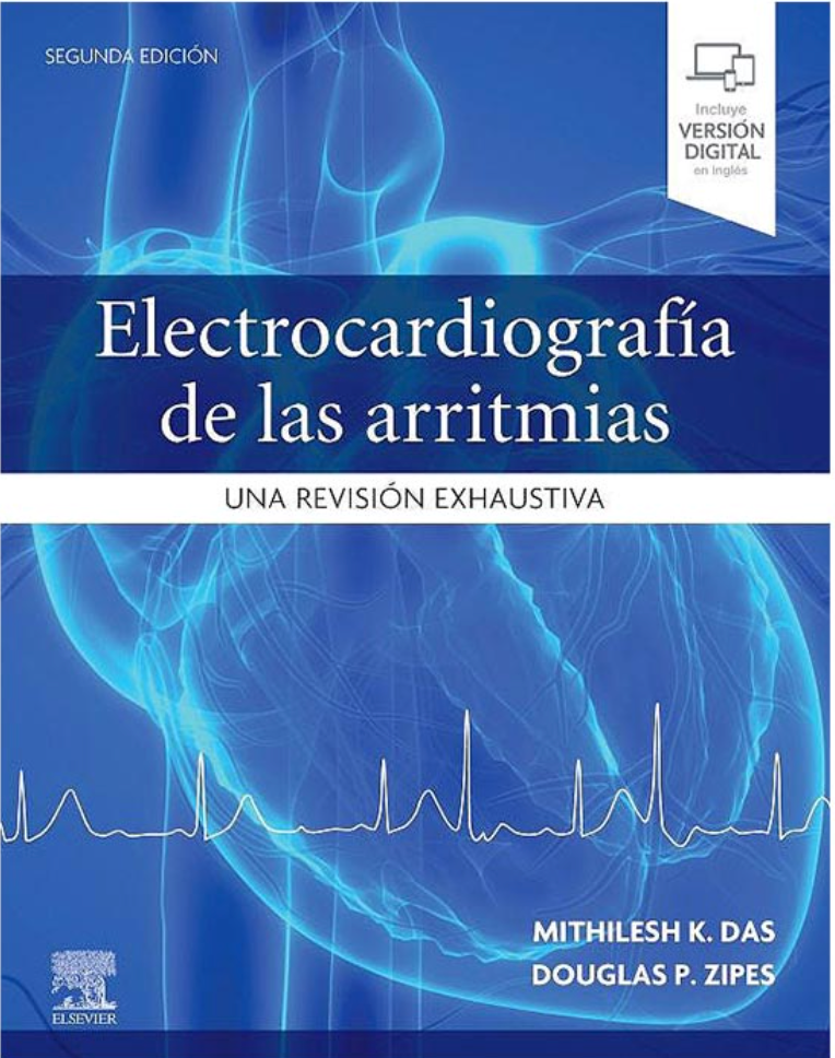 Electrocardiografía de las Arritmias. Una Revisión Exhaustiva