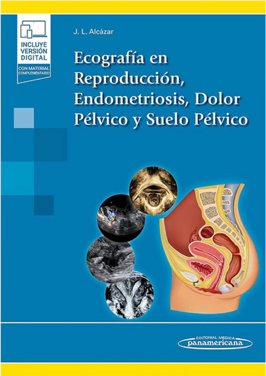 Ecografía en Reproducción. Endometriosis. Dolor Pélvico y Suelo Pélvico