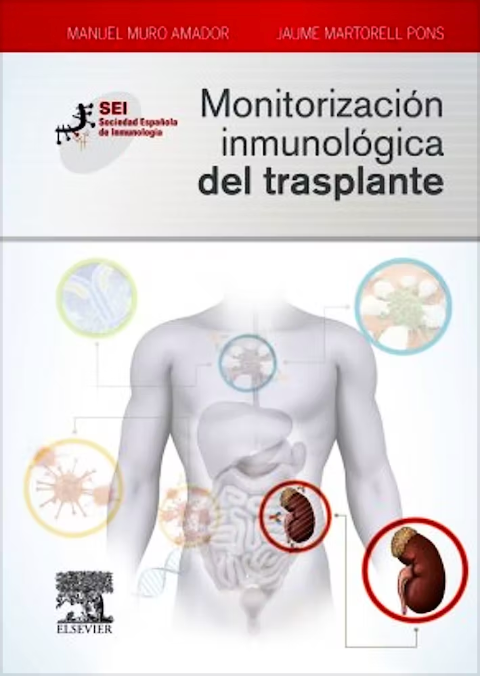 Monitorización inmunológica del transplante