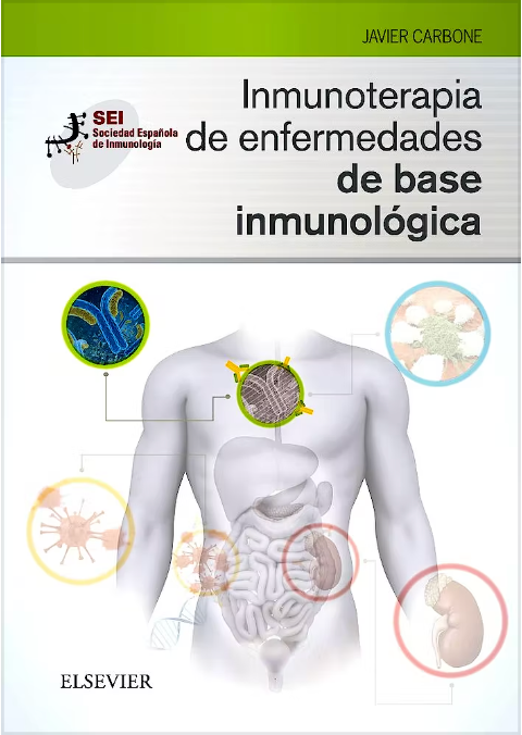 Inmunoterapia de Enfermedades de base inmunológica