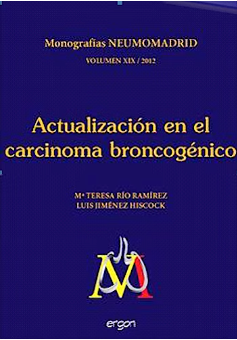 Actualización en el carcinoma broncogénico