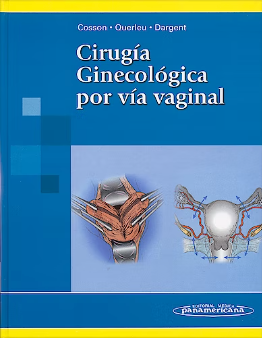 Cirugía Ginecológica por vía vaginal