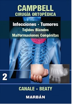 Cirugía Ortopédica - Infecciones, Tumores, Tejidos Blandos, Malformaciones Congénitas. Tomo 2