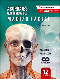 Abordajes Quirúrgicos del Macizo Facial