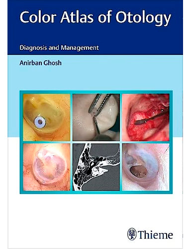 Color Atlas of Otology. Diagnosis and Management