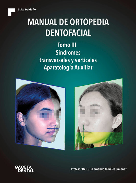 Manual de Ortopedia Dentofacial, Tomo III. Síndromes Transversales y Verticales. Aparatología Auxiliar