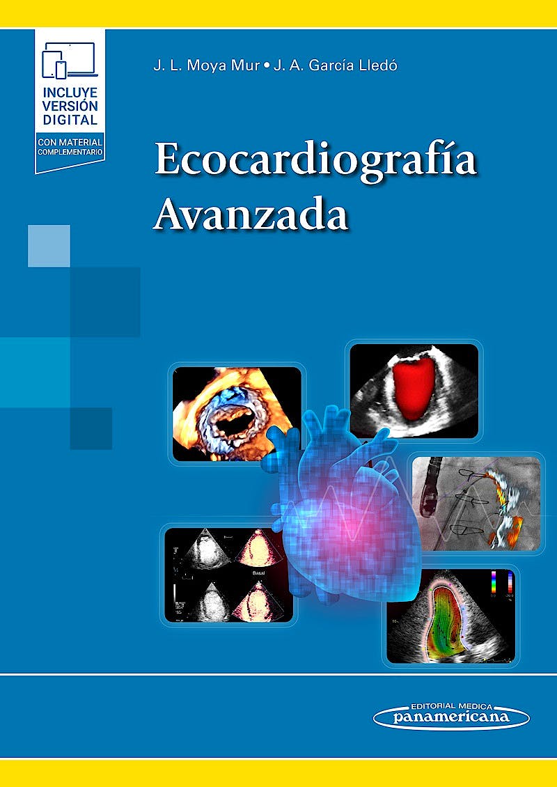 Ecocardiografía Avanzada